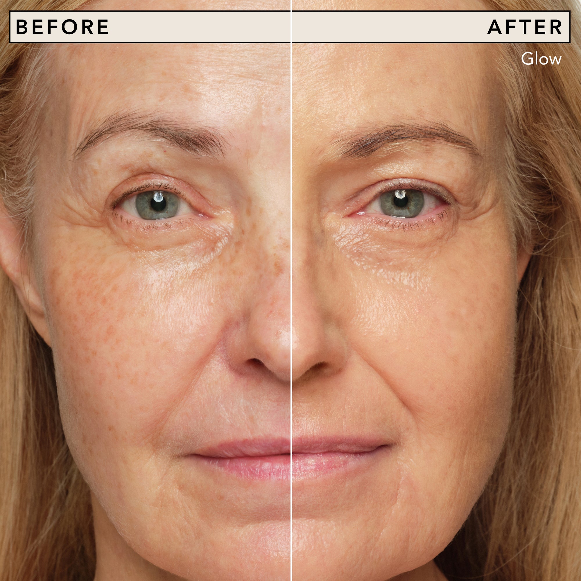 Just Skin Tinted Moisturizer (Canada) – Chantecaille